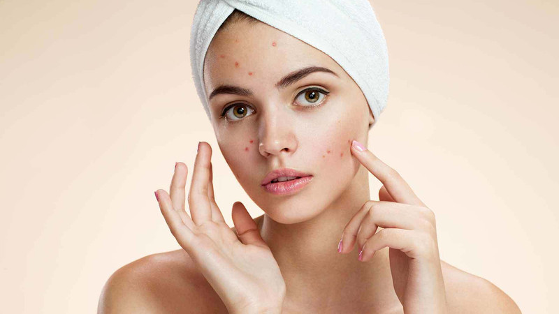 Người bị mụn trứng cá nên cân nhắc khi ăn bánh trung thu